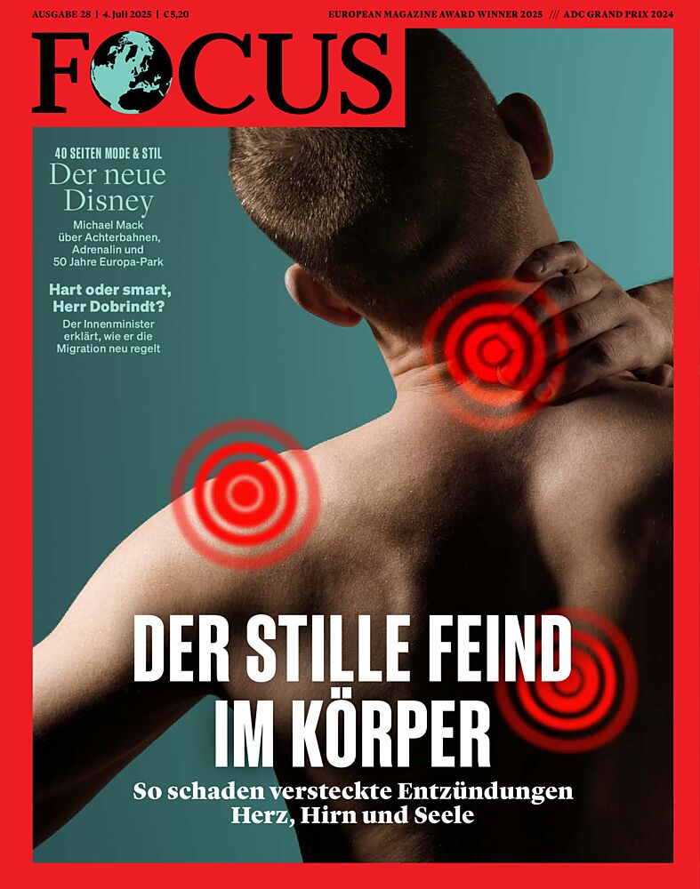 Focus Cover